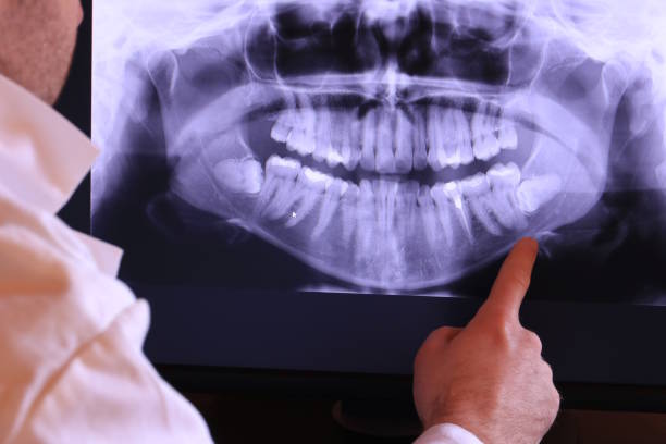 Best Emergency TMJ Treatment in Emerald Bay, TX
